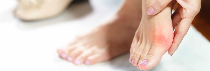 hallux valgus